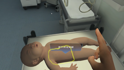 新生儿cpr+抚触